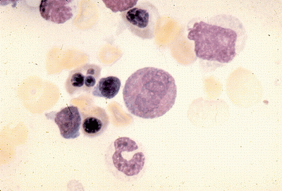 HEMATOPOEZA-Eosinofilní Metamyelocyt.gif