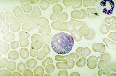 HEMATOPOEZA-Eosinofilní myelocyt.gif