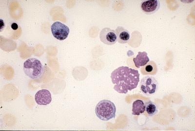HEMATOPOEZA-Erythropoeisis několik fází 1.gif