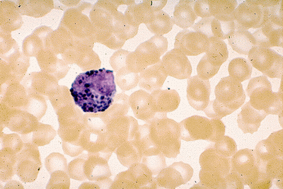 HEMATOPOEZA-Metamyelocyt.gif
