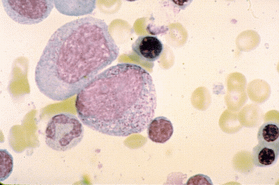 HEMATOPOEZA-Promyelocyt.gif