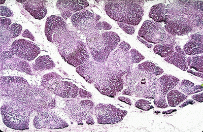 Imunitní systém-Thymus-panoramaticky.gif